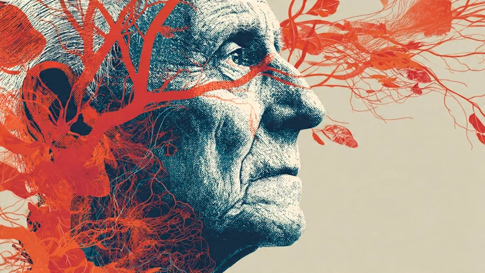 Vascular dementia symptoms and treatment